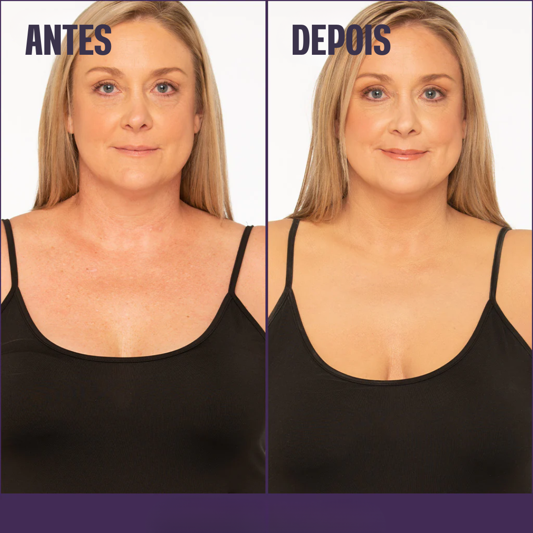 Base Corporal Iluminadora - Remove Manchas✨