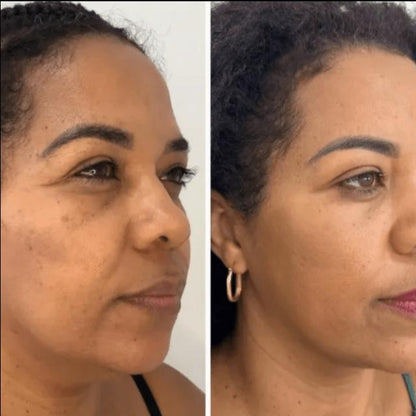 Collagen Fit™ - Máscara Rejuvenescedora de Colagénio, 2 UNIDADES