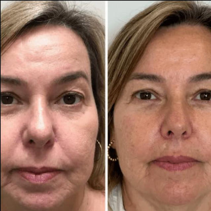 Collagen Fit™ - Máscara Rejuvenescedora de Colagénio, 2 UNIDADES