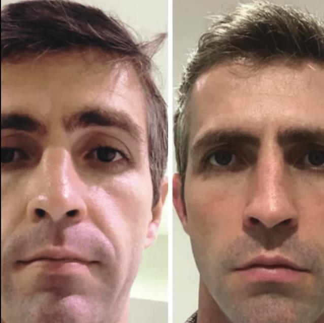 Collagen Fit™ - Máscara Rejuvenescedora de Colagénio, 2 UNIDADES