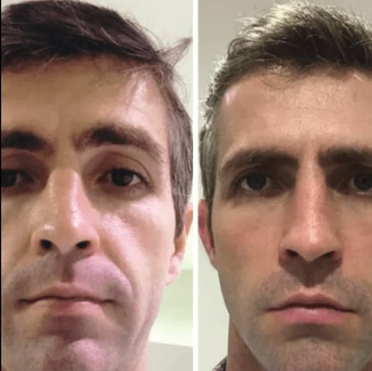 Collagen Fit™ - Máscara Rejuvenescedora de Colagénio, 2 UNIDADES