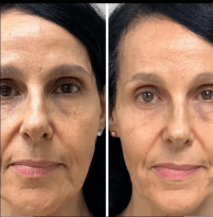 Collagen Fit™ - Máscara Rejuvenescedora de Colagénio, 2 UNIDADES