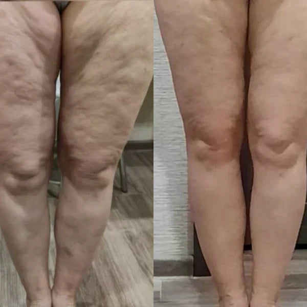 CelluFree 4D