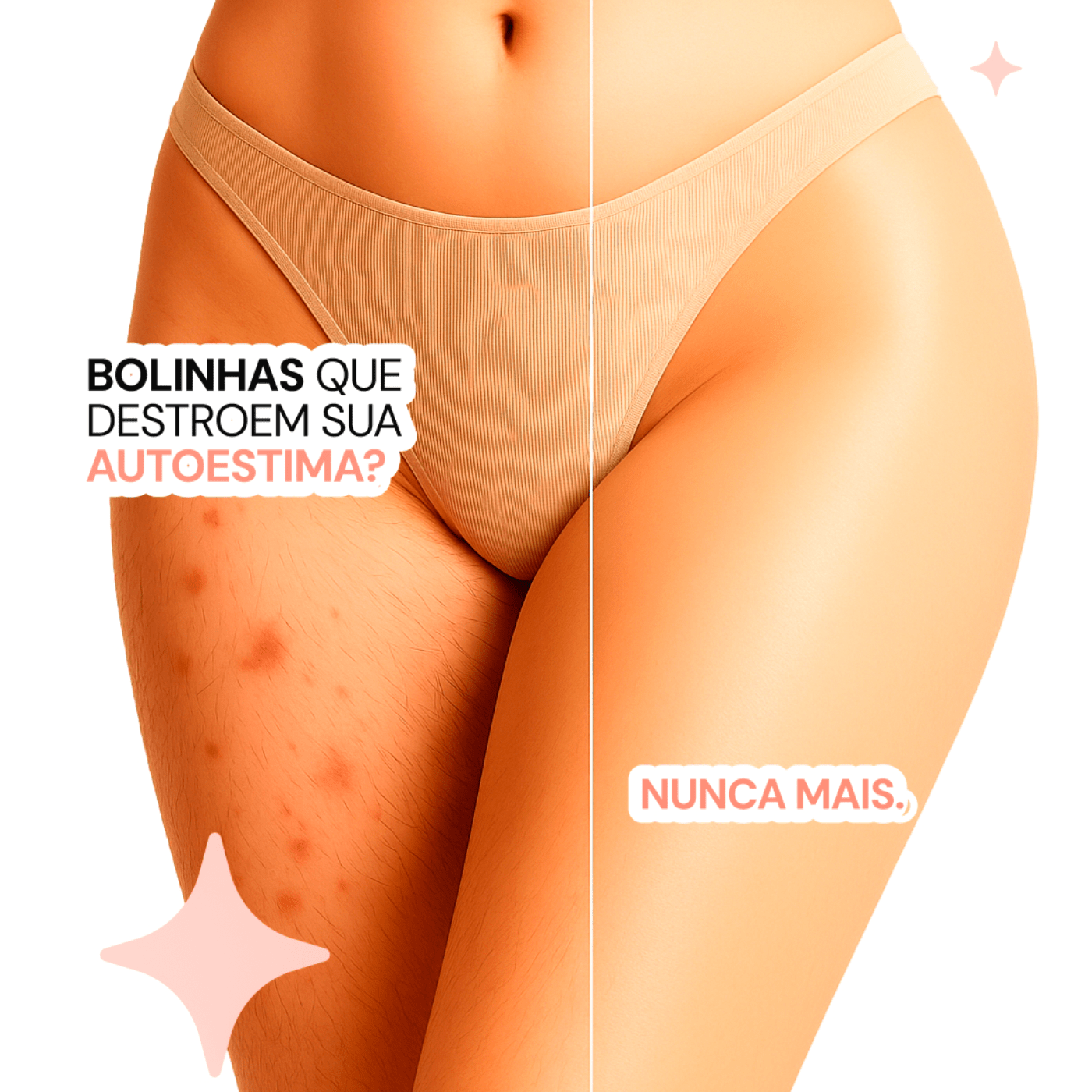 Depilador Anti Foliculite – Pele Lisinha sem Pelos Encravados