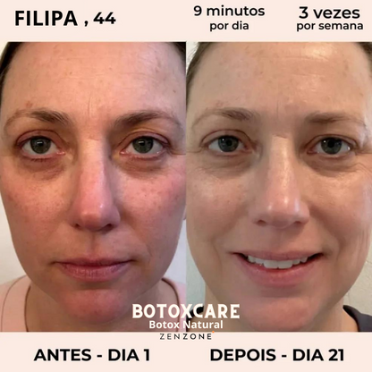 Magic Care Laser 4 em 1 (Portes Grátis Esta Semana)