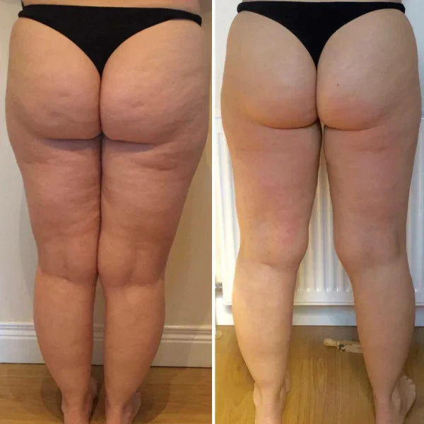 CelluFree 4D