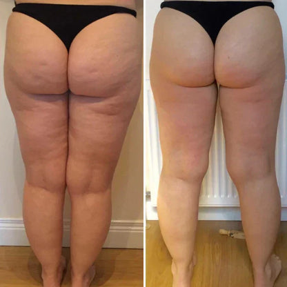 CelluFree 4D