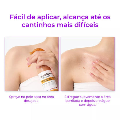 Melashot – Spray Esfoliante Corporal Que Clareia Manchas e Deixa a Pele Lisa e Iluminada em Minutos